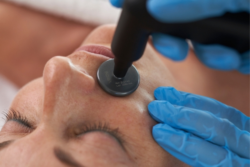 nieinwazyjny lifting twarzy